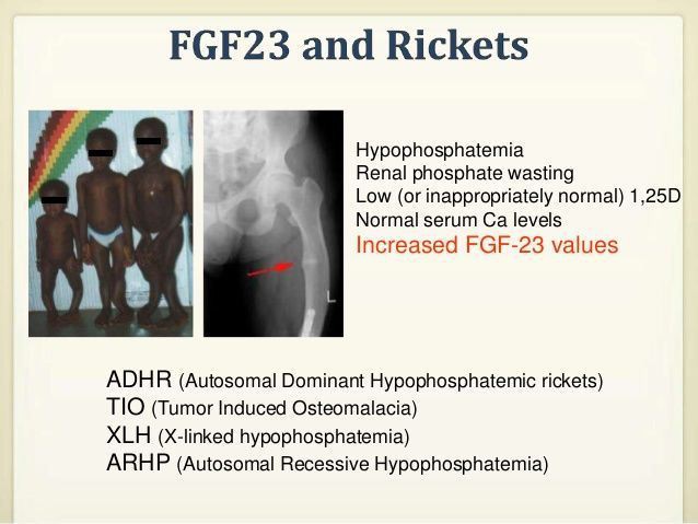 fgf-23